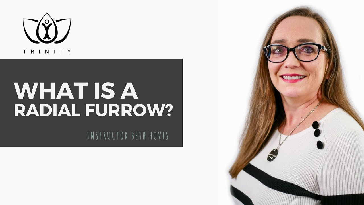 Iridology Terms - What is a Radial Furrow?