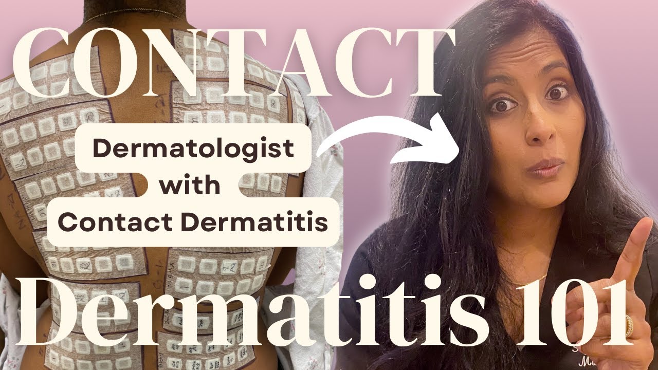 I'm a Dermatologist with Severe Allergic Contact Dermatitis: What I wish I knew.