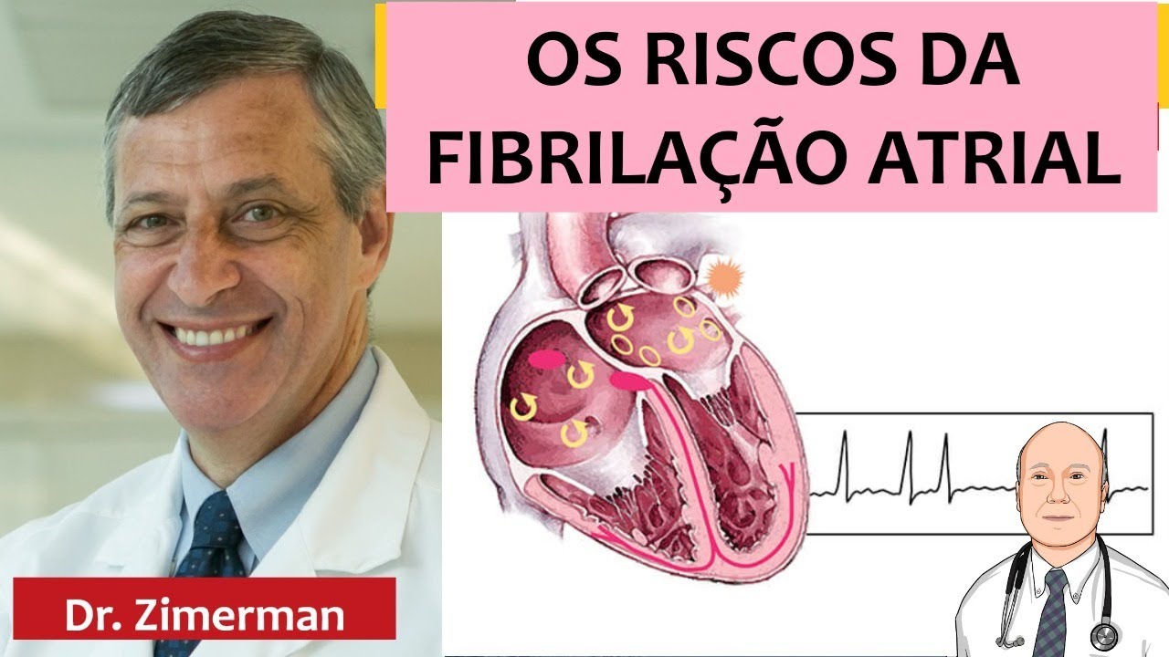 Fibrilação atrial é uma arritmia cardíaca comum, importante de diagnosticar e tratar