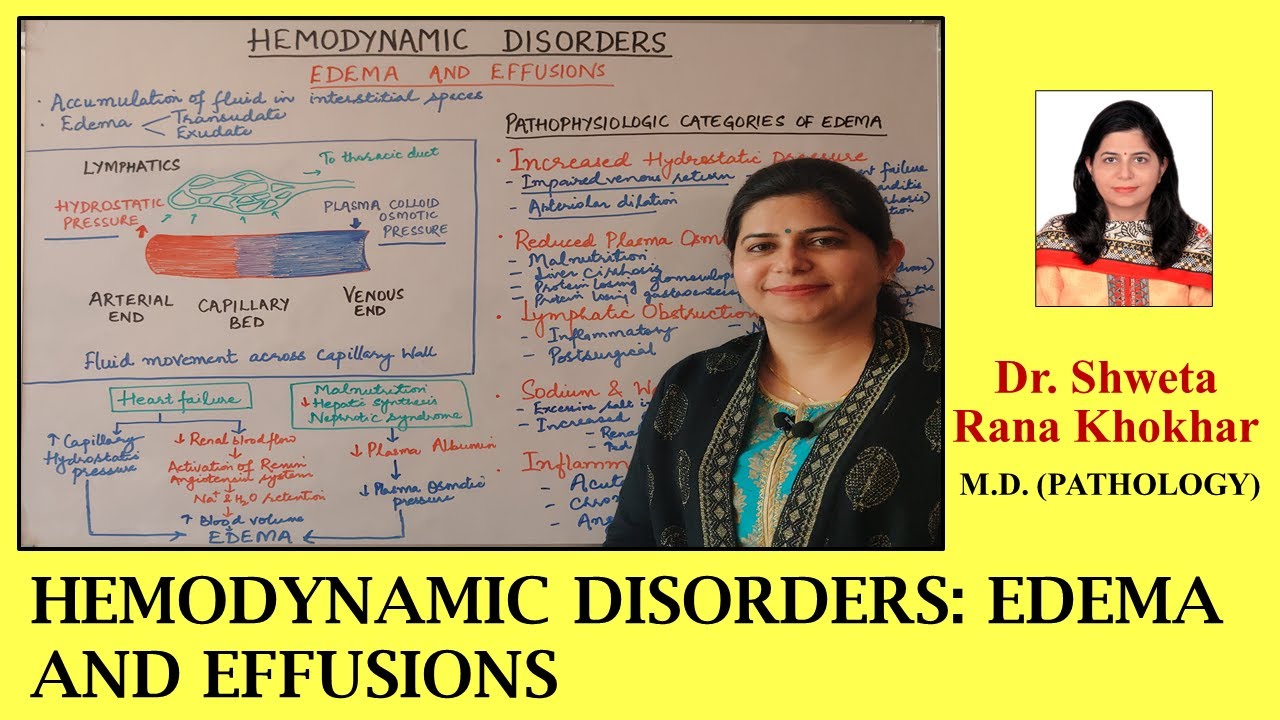EDEMA AND EFFUSIONS | Pathophysiologic categories of edema | HEMODYNAMIC DISORDERS