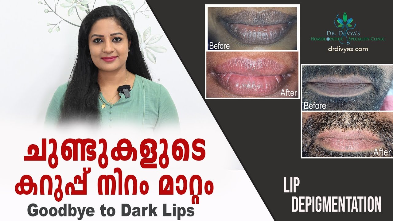 ചുണ്ടുകളുടെ കറുപ്പ് നിറംമാറ്റാൻ Lip Depigmentation Treatment |Dark Lip Correction|Celebrity's Secret