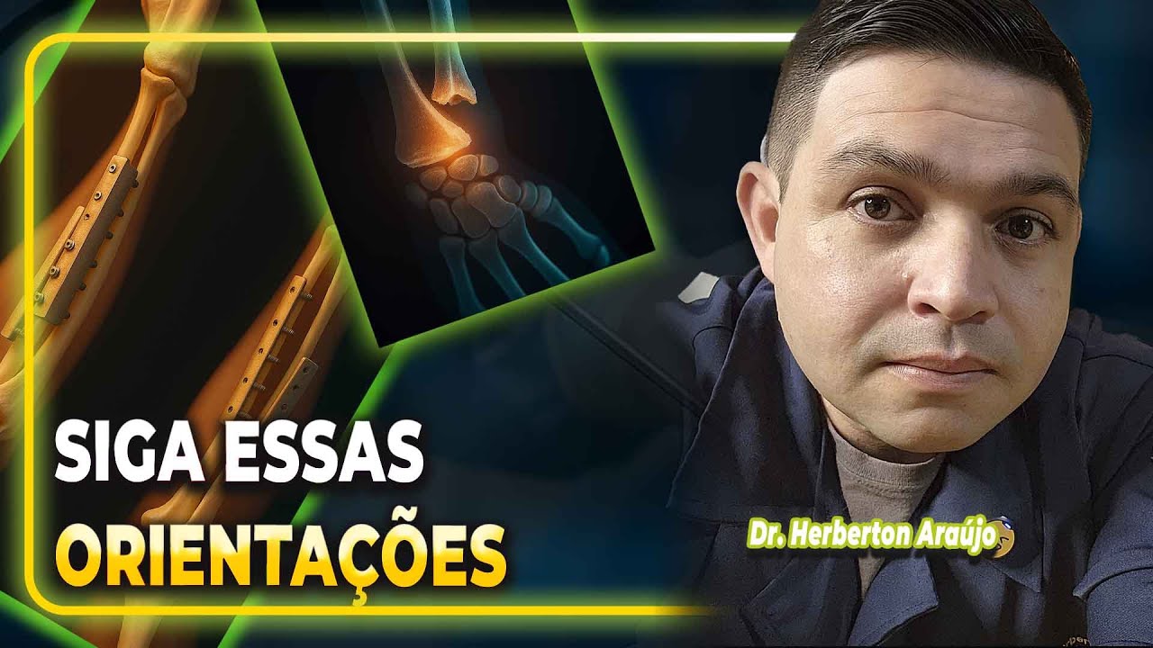 Artrofibrose e Fratura: O que Ninguém tem coragem de Contar. 