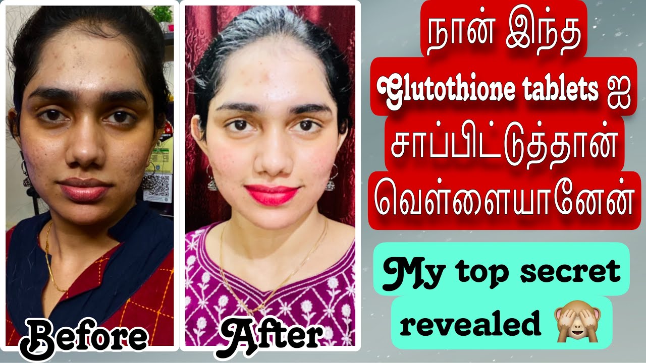நான் இந்த Glutothione tablets ஐ சாப்பிட்டுத்தான் வெள்ளையானேன்😇💯CHICNUTRIX GLOW