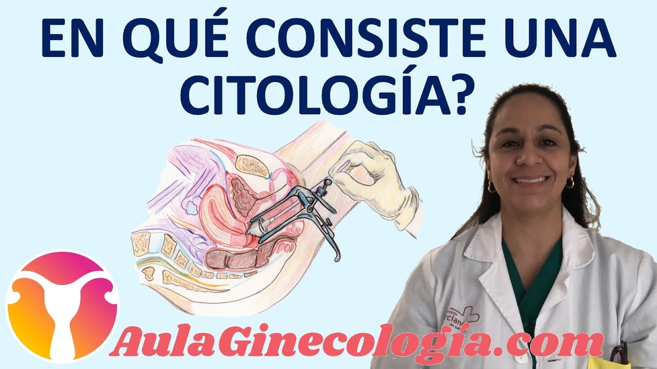 &iquest;EN QU&Eacute; CONSISTE UNA CITOLOG&Iacute;A o PRUEBA DE PAPANICOLAU?   - Ginecolog&iacute;a y Obstetricia -.