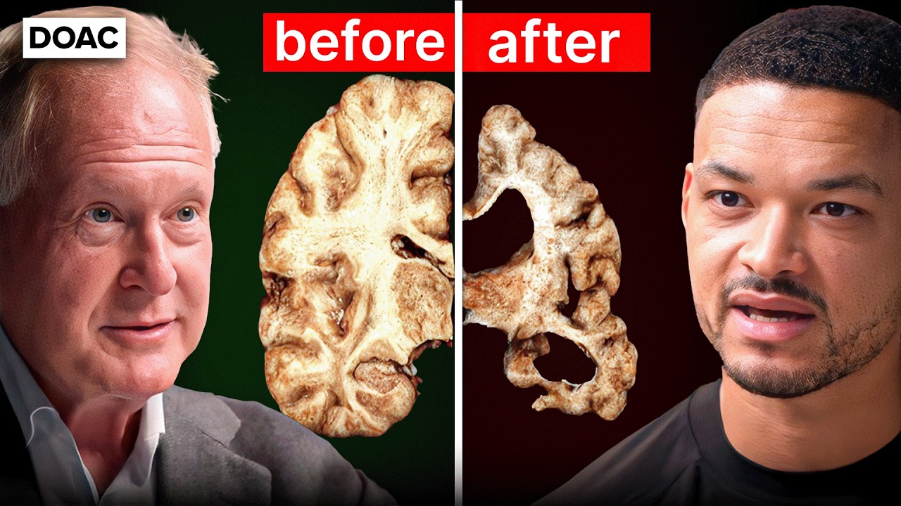 The REAL Reason Dementia Is Skyrocketing