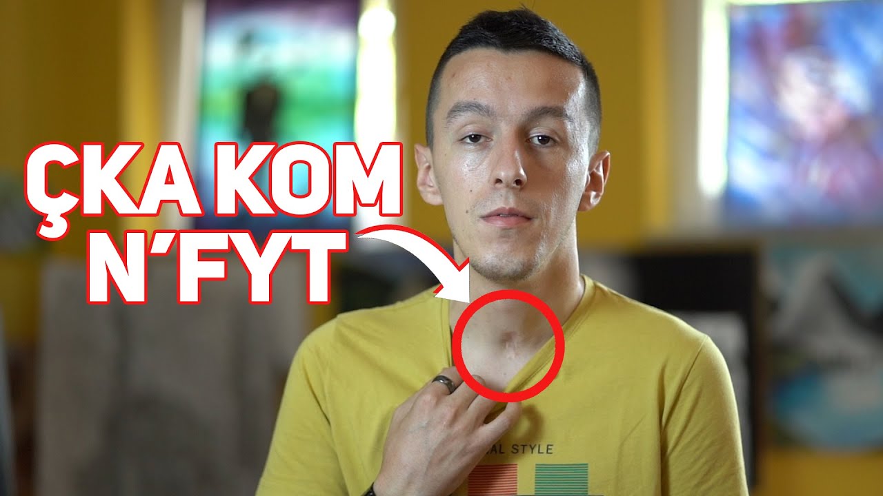 Çka kom n'Fyt?! | Agon Gashi