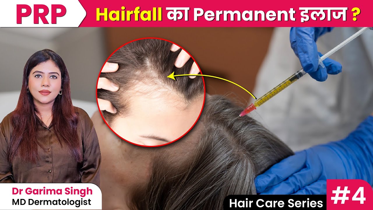 PRP Hair Treatment: Permanent Solution Ya Marketing Scam? | सच्चाई जानिए Dermatologist से!