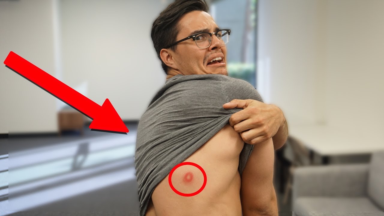 What Happened  to Gunner's Back?!