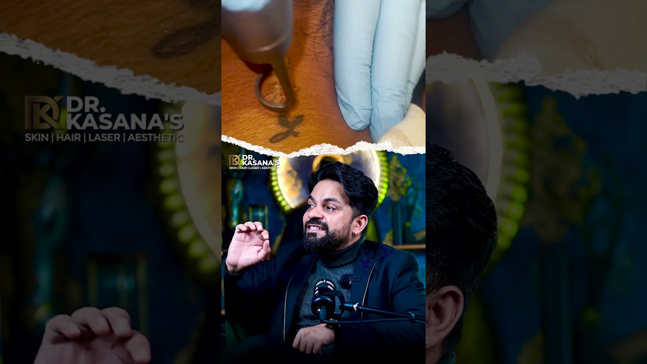 Tattoo Removal with Advanced Laser Technology 