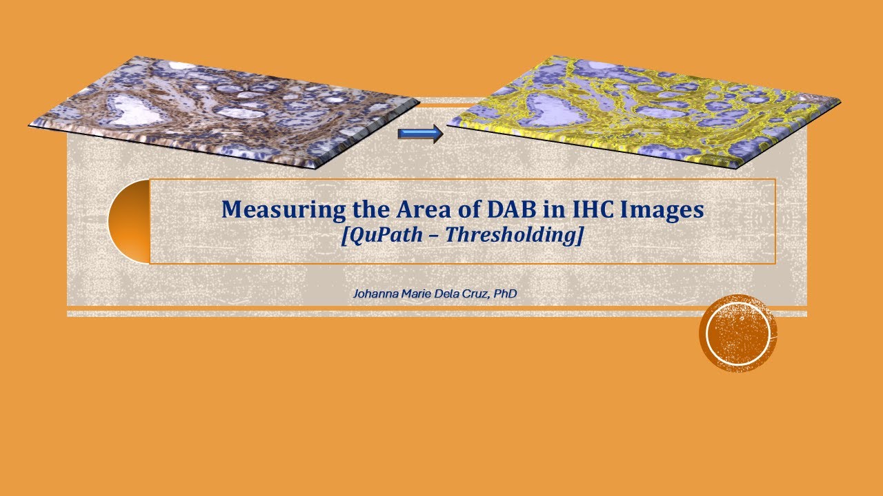 Measuring the Area of DAB in IHC images [QuPath - Thresholding]