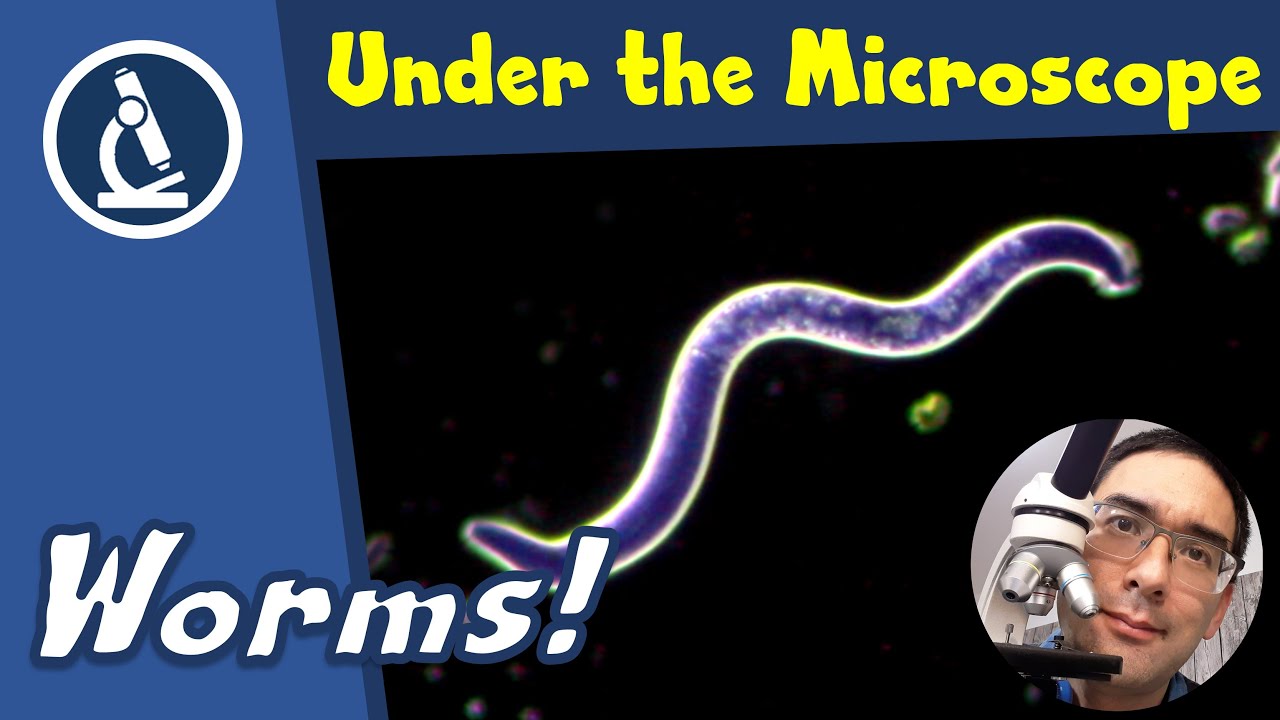 🔬 128 - Where you can find microscopic WORMS | Amateur Microscopy