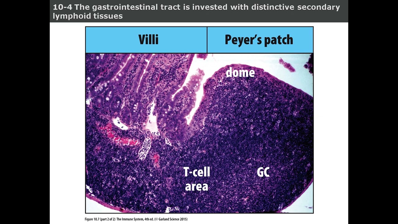 Chapter 10 Mucosal Immunity Explained: IgA, Gut Defense, and Intestinal Immune Cells