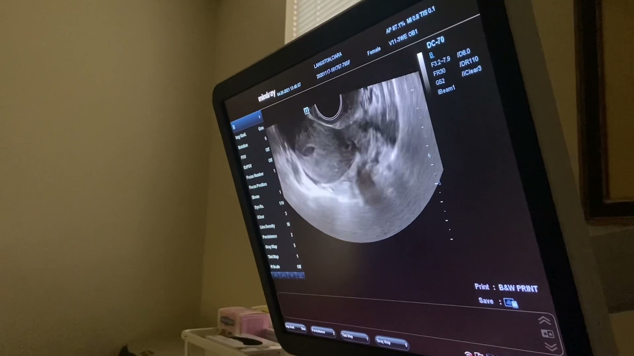 Confirmation of heartbeat appointment