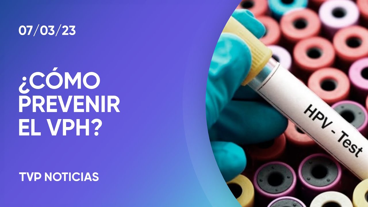 C&oacute;mo prevenir el virus del papiloma humano