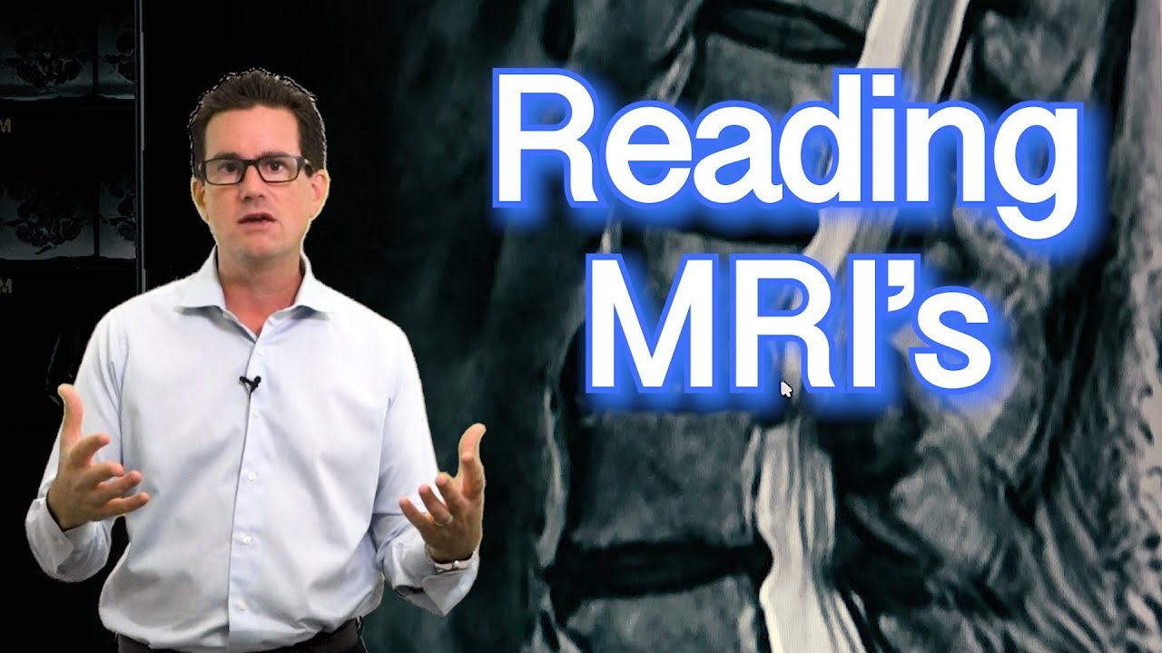 Understanding a Spine MRI for Chiropractic Care and Spinal Decompression Therapy
