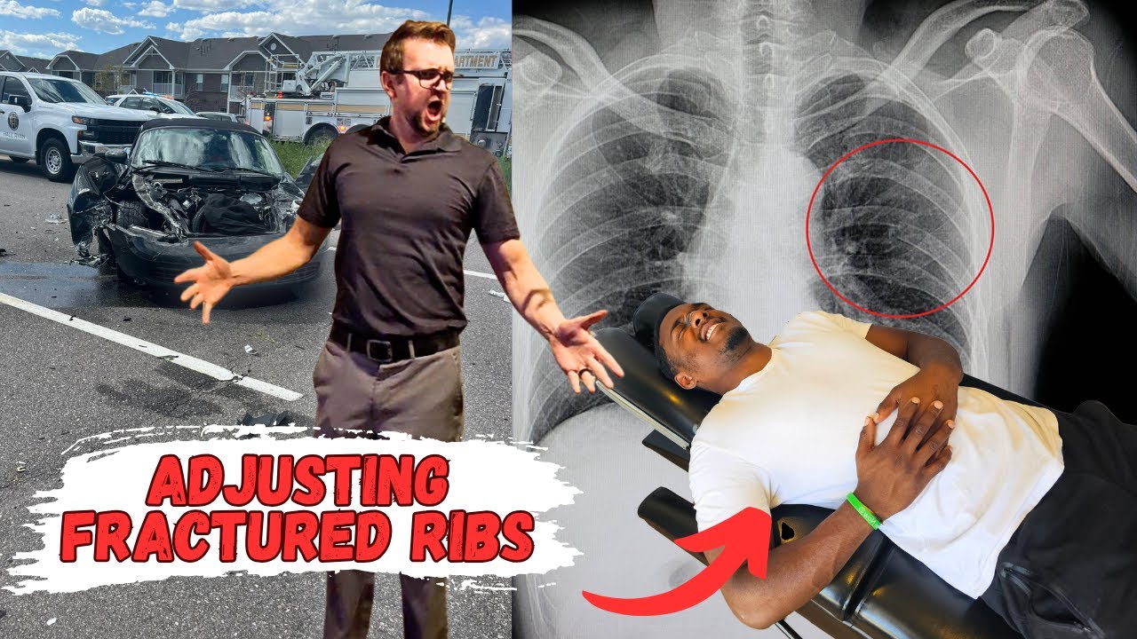 Adjusting Fractured Ribs | Dr Randy Cracks