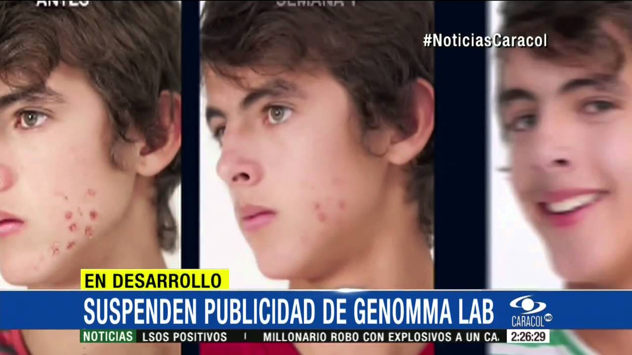 Levantan pliego de cargos contra Genomma Lab por publicidad engañosa