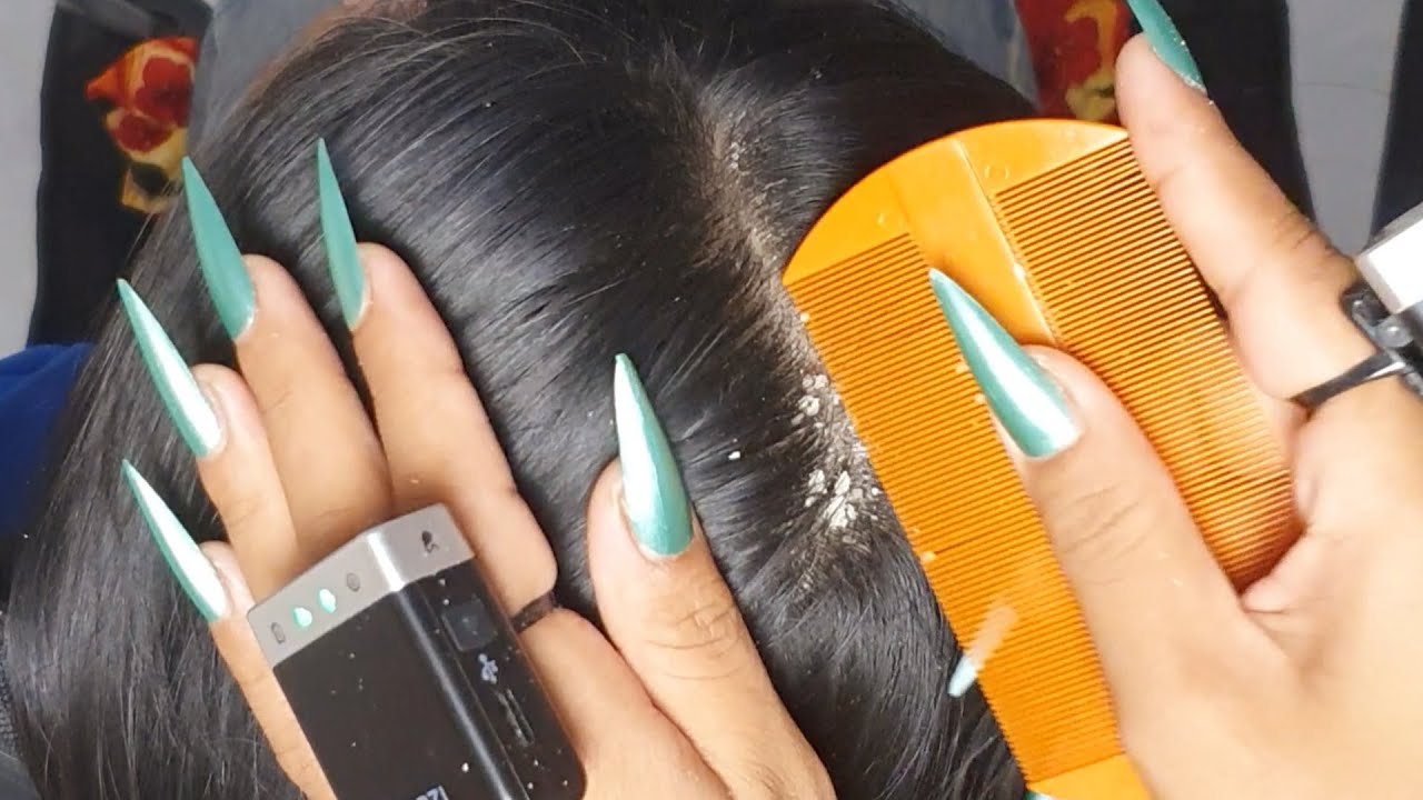 Deep Flake Focus ASMR 🌙 | Slow Nail Scratching, Dry Scalp Lift & Sleepy Tingles #VF0075