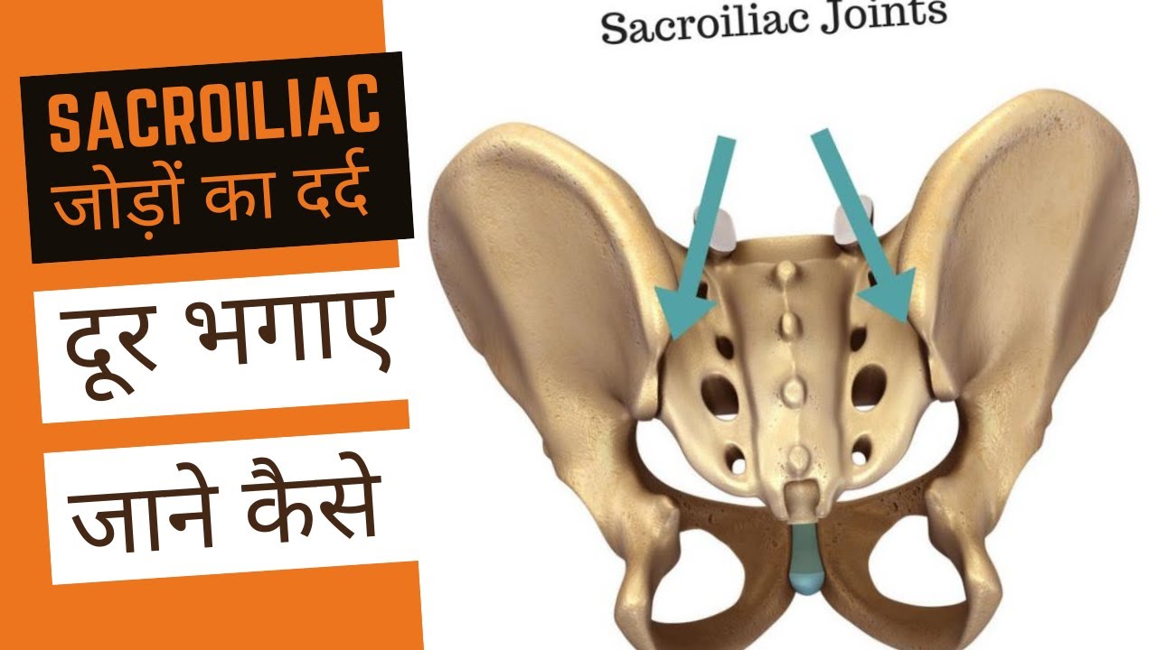 Sacroiliitis | Symptoms | Homeopathy Medicine & Treatment | Sacroiliac Joint Pain | By Dr. Ramdeo
