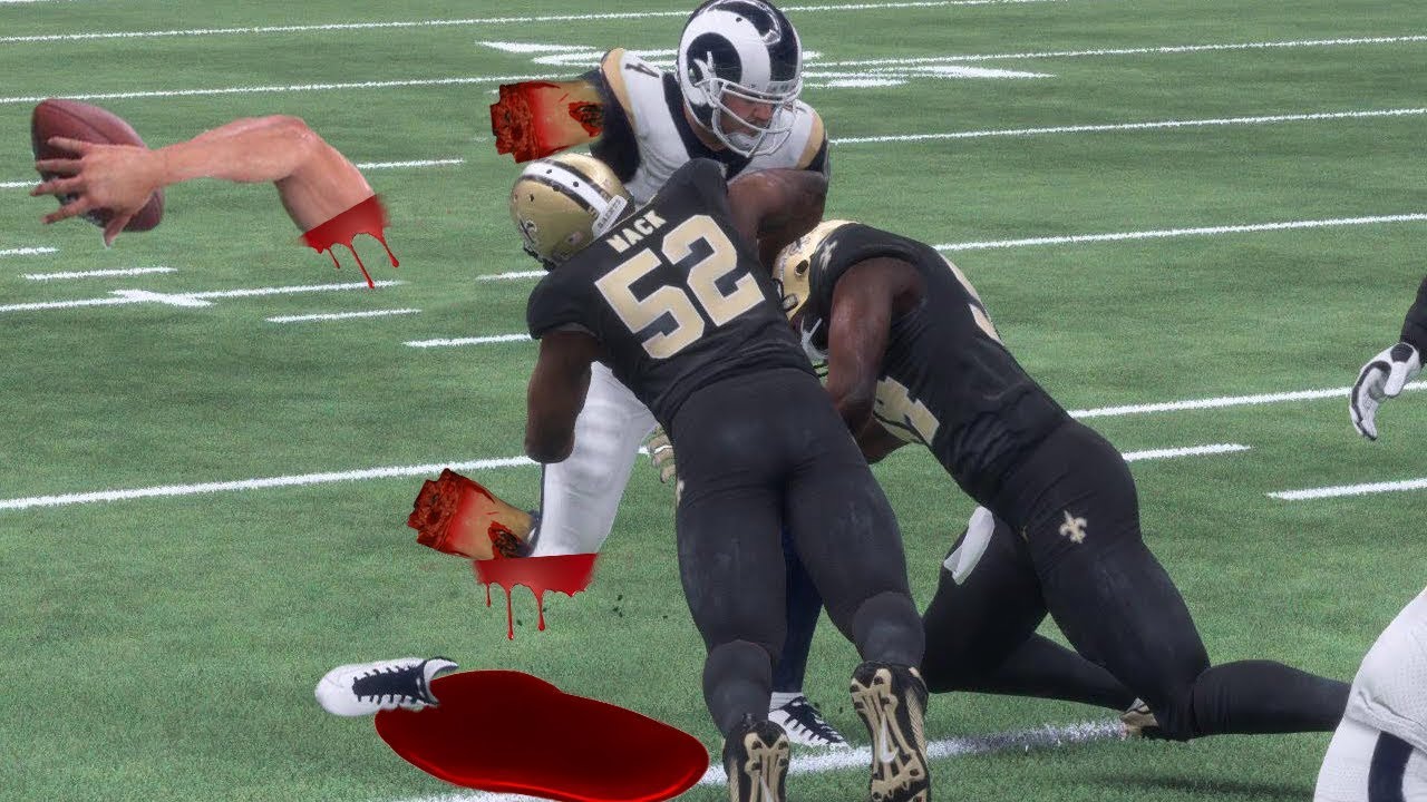 BROKEN LEG AND ARM FROM NASTY BIG HITSTICK INJURY WOW! - Madden NFL 18 MUT Gameplay Madden 18
