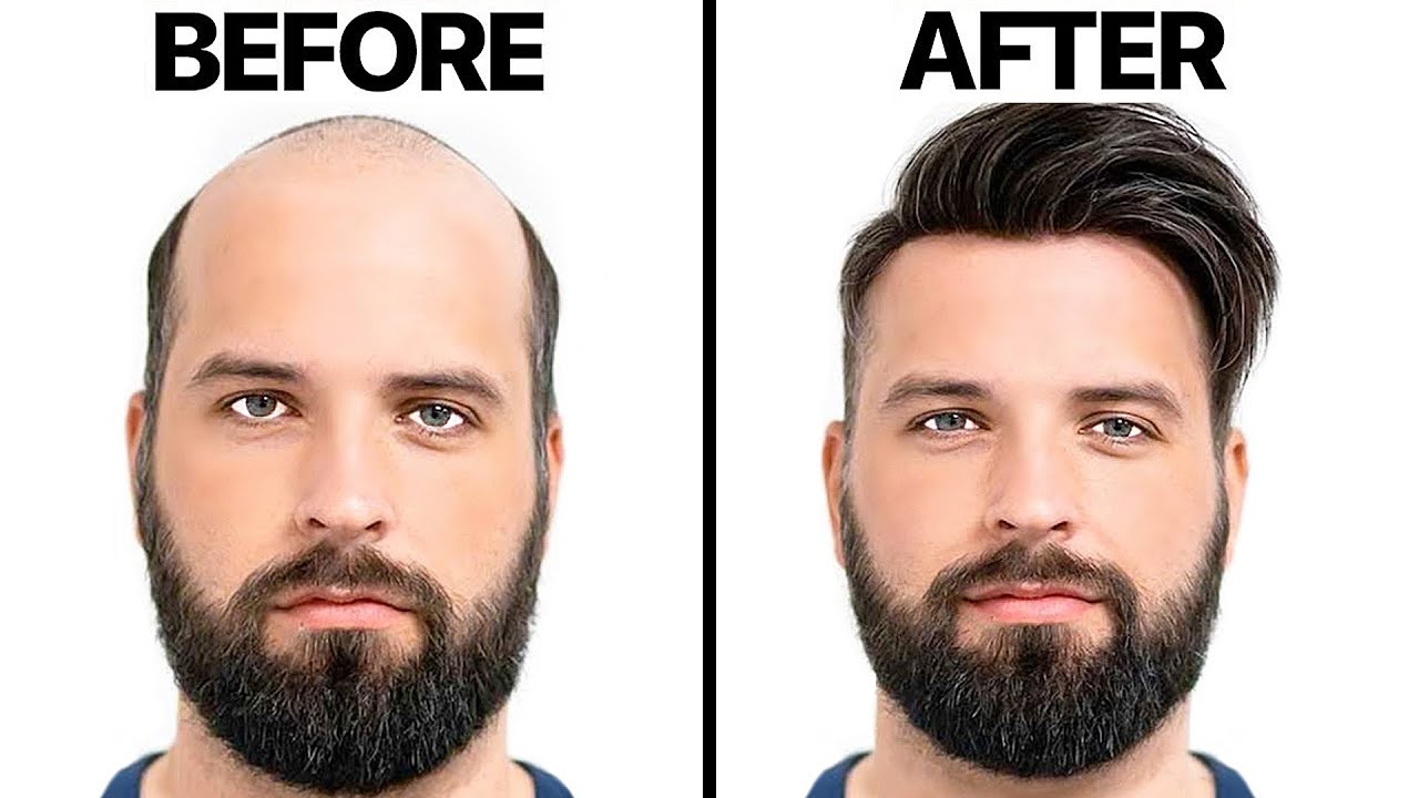 THIN Hair to THICK Hair Naturally | 11 Home Remedies for Hair Regrowth
