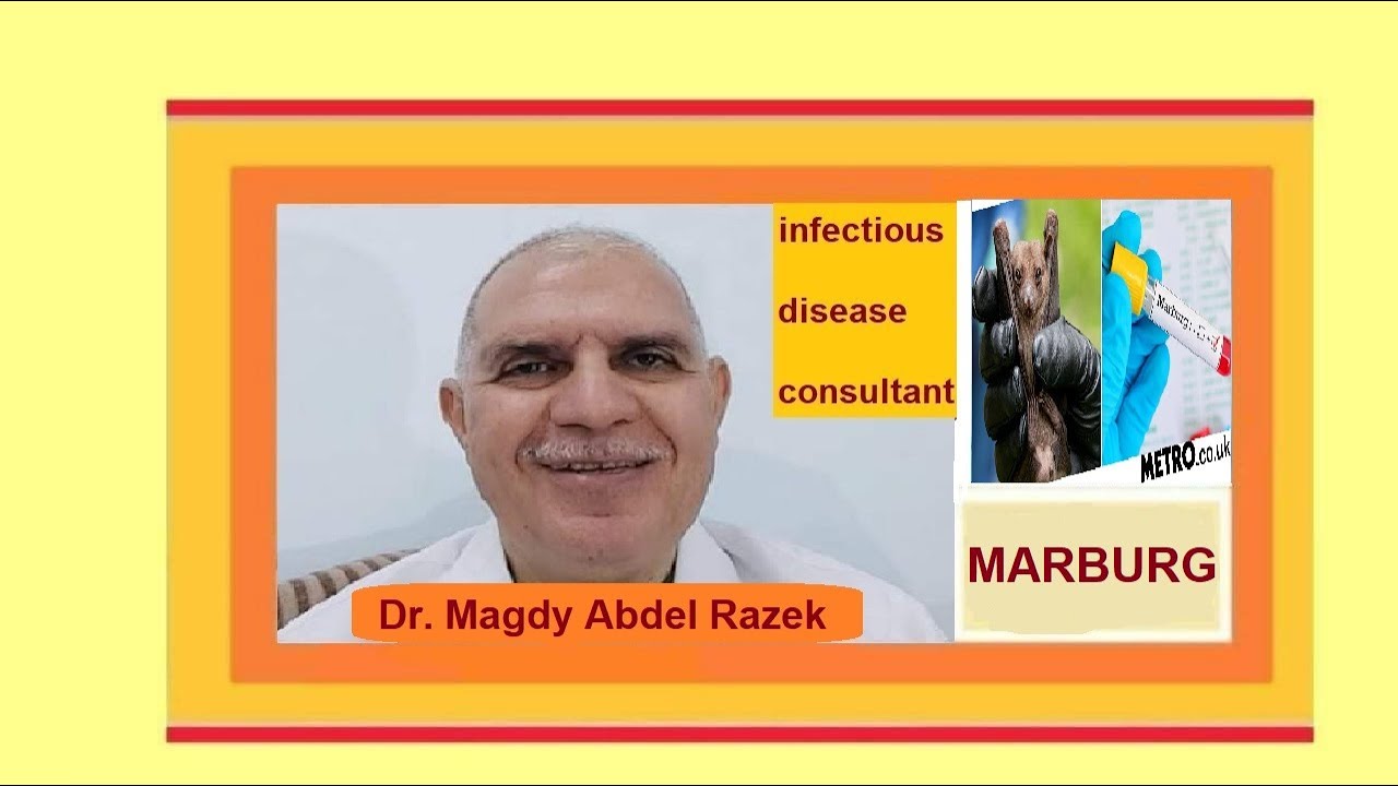 MARBURG VIRUS IS FATAL VIRUS, HEMORRHAGIC FEVER