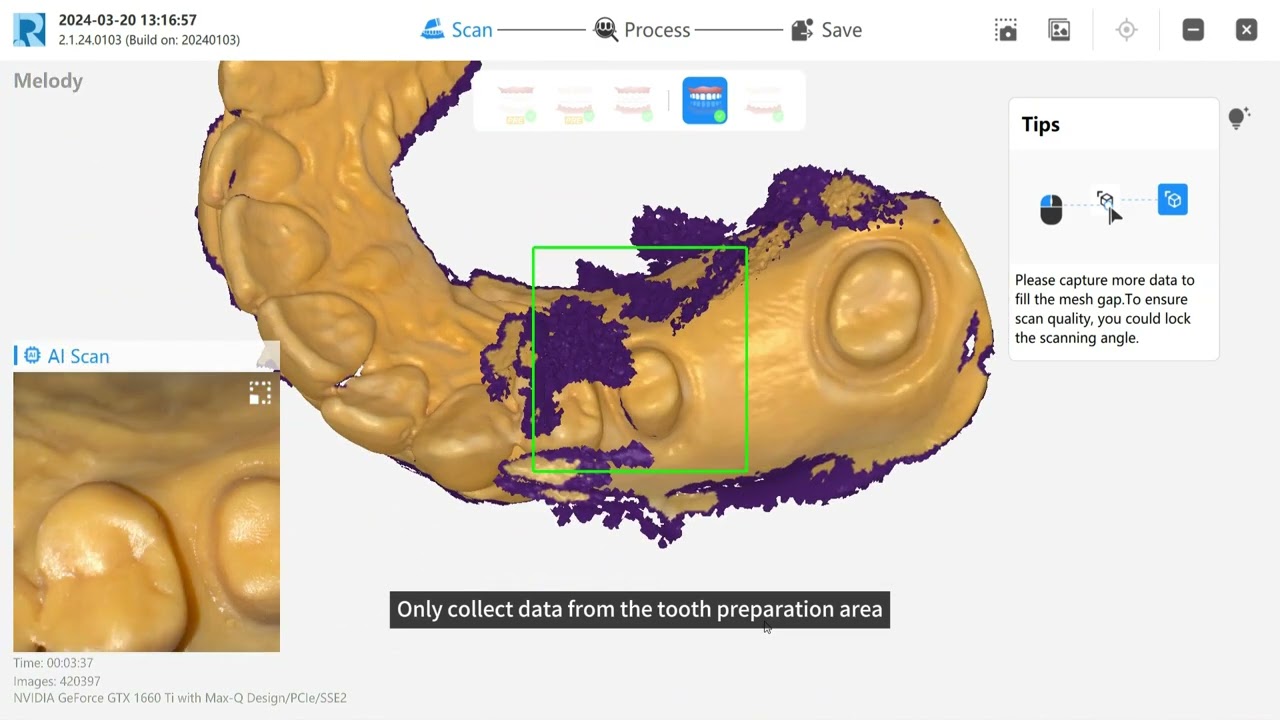 8.Preoperative Scan Operation Guide