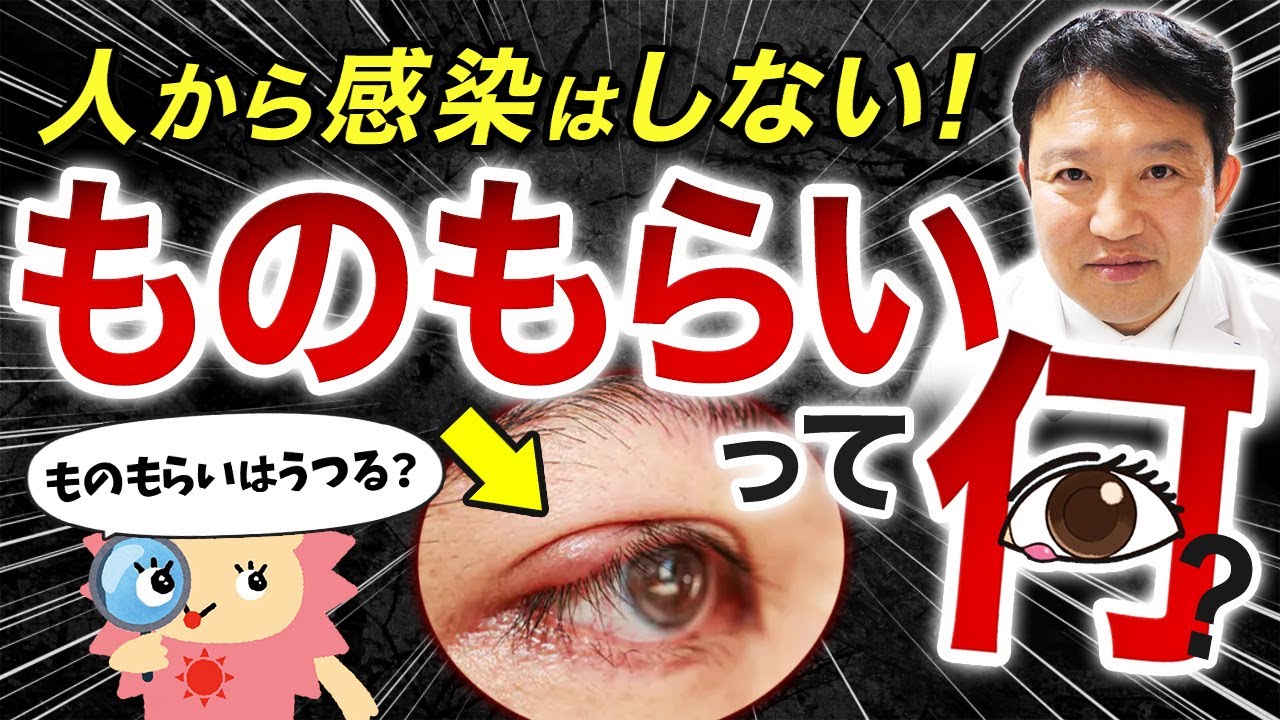 【放置厳禁】ものもらいってうつるの？治し方について眼科医が解説します！