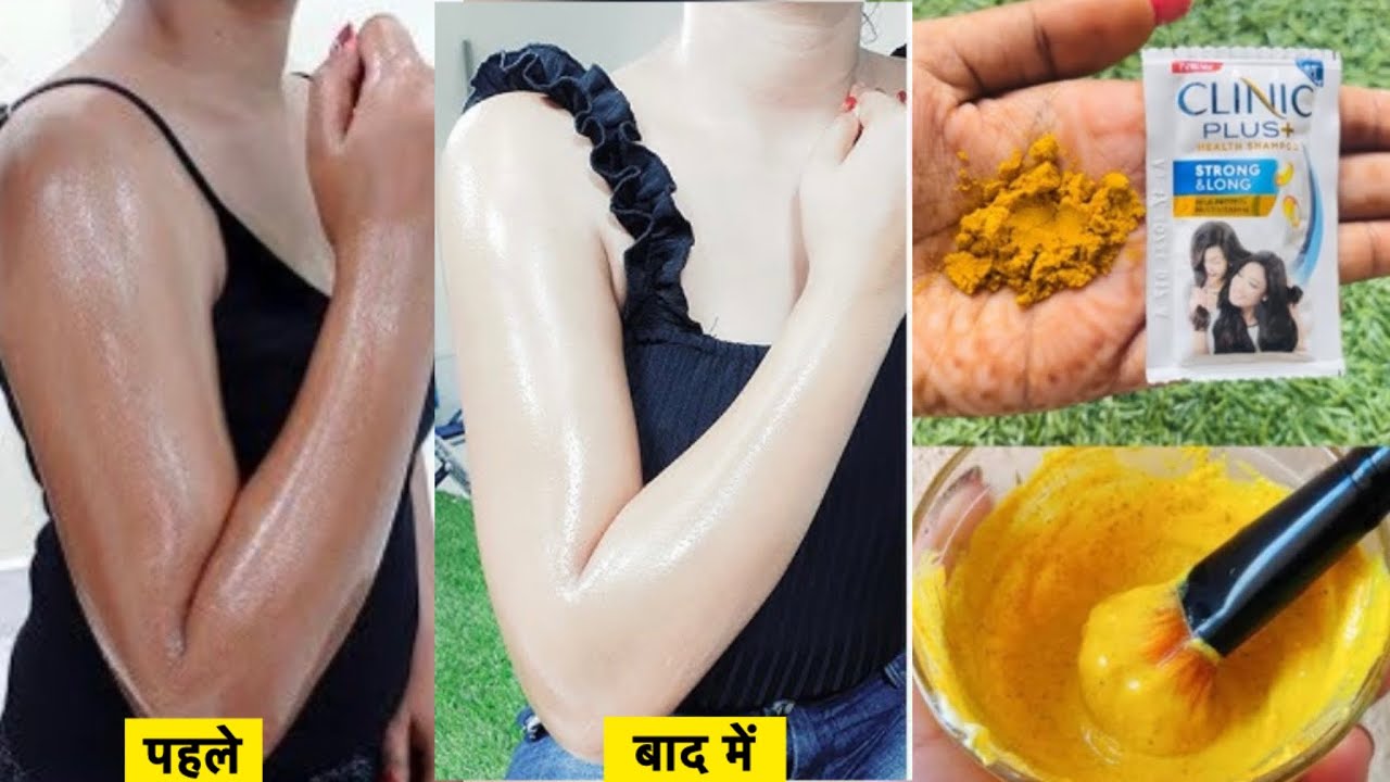 शैम्पू में बस एक बार ये मिला कर लगा लो सब हैरान होजायेगे देखकर हाथ पैर इत्ते गोरे होजायेगे 