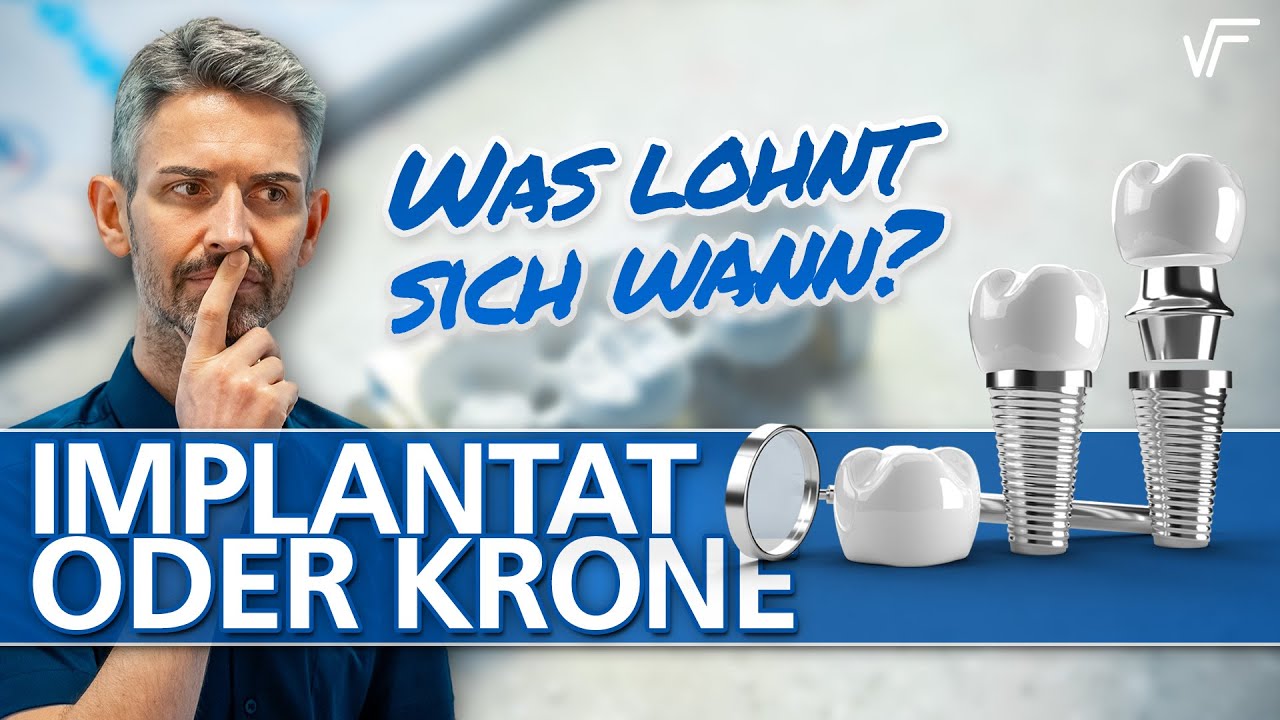 Zahnersatz - Implantat vs. Krone