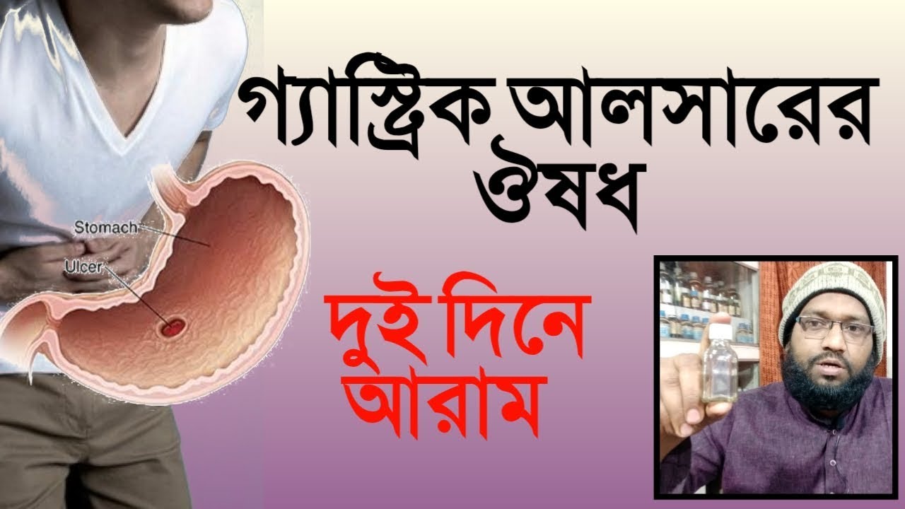 গ্যাস্ট্রিক আলসার থেকে মুক্তির উপায় | হোমিওপ্যাথি ও বায়োকেমিক চিকিৎসা | gastric ulcer