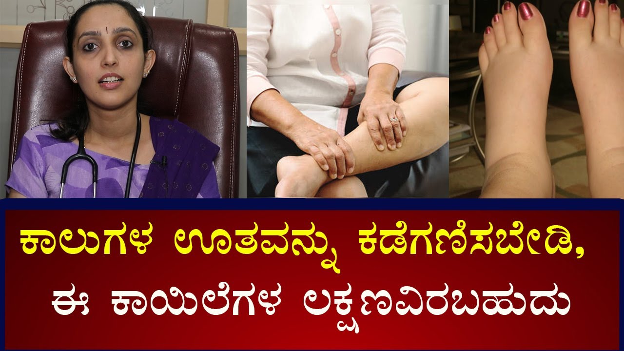 Swollen Feet and Ankles: Causes & Symptoms | Vijay Karnataka