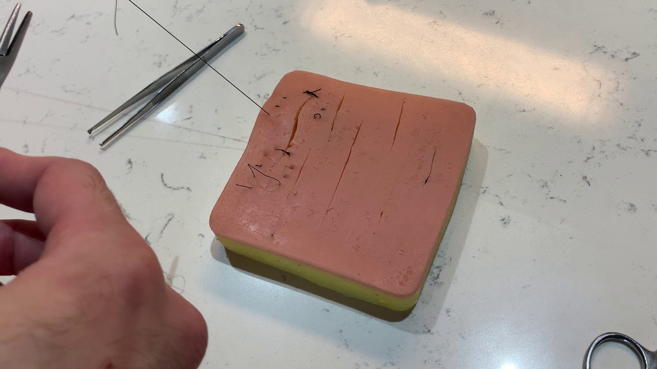 Running Vertical Mattress Suture