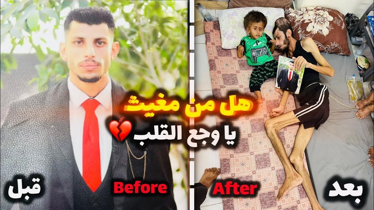 ثاني أغرب حالة في غزة💔🇵🇸بوجع القلب😱