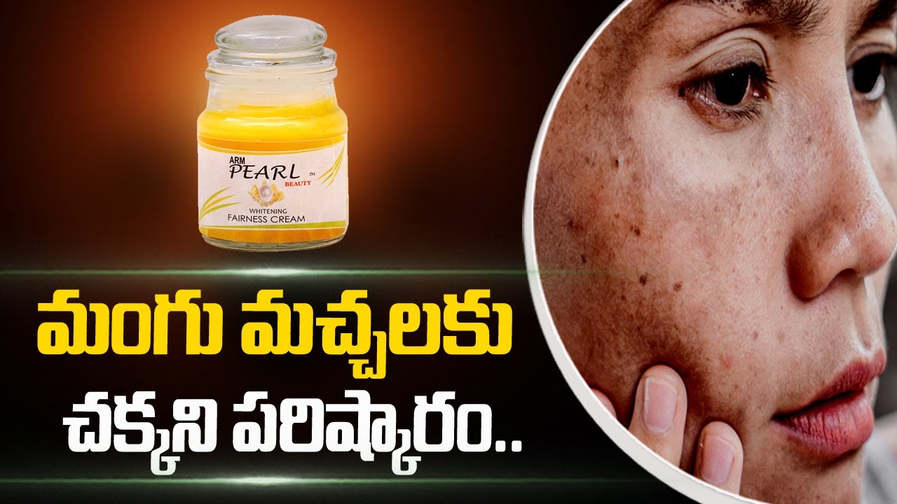 How To Get Rid Of Dark Spots | Best Remedy for Mangu Machalu | Pearl Beauty | SumanTV Telugu