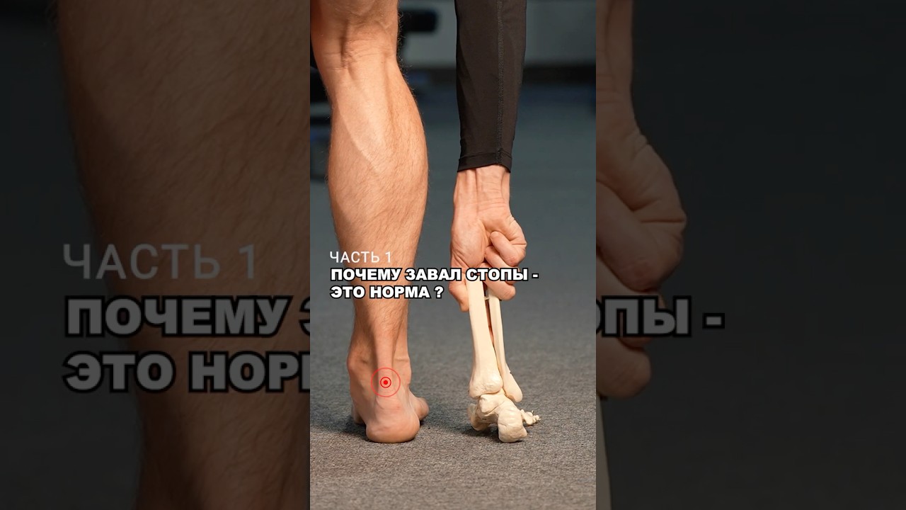 Почему ЗАВАЛ СТОПЫ - ЭТО НОРМА? Adidas и ВРЕД &ldquo;СПЕЦИАЛЬНОЙ&rdquo; обуви для бега. Часть 1.