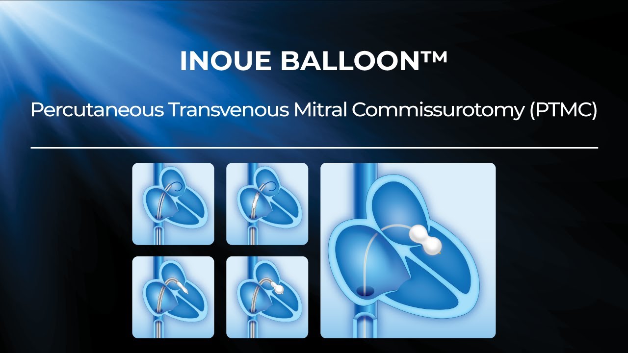 INOUE BALLOON CATHETER  - FULL TUTORIAL