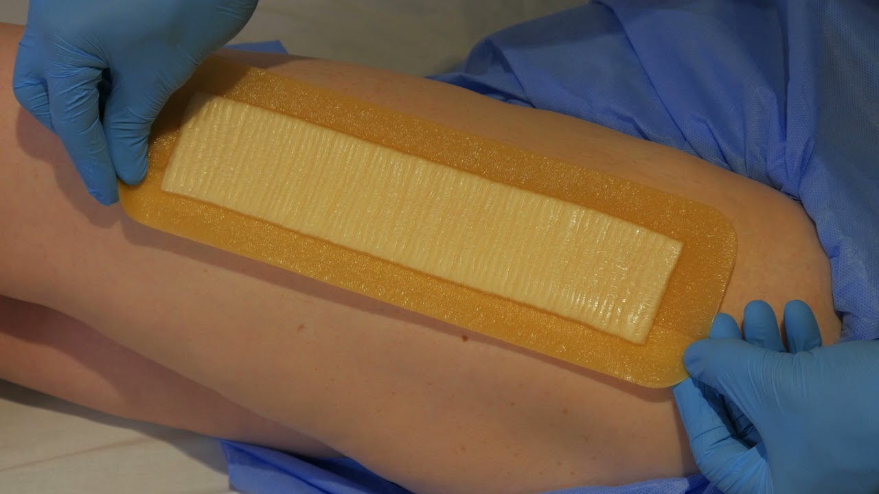 AQUACEL Surgical post-op dressing application on a hip