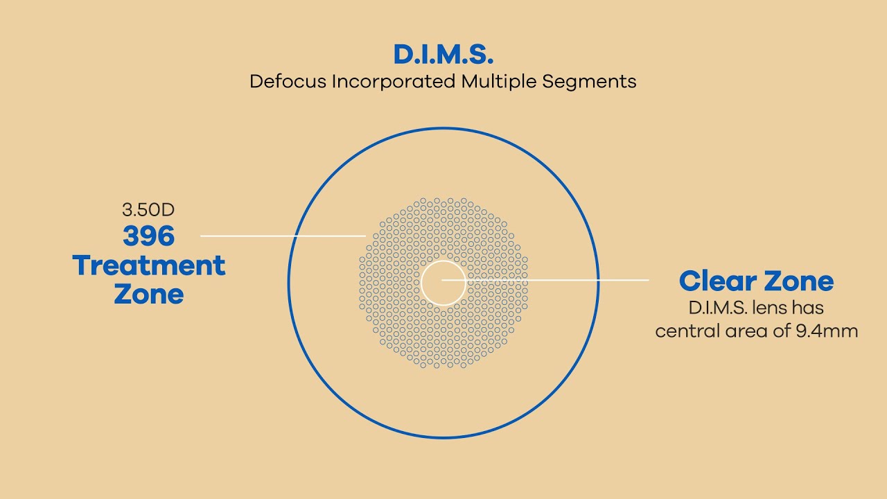 MiYOSMART - Revolutionary Children&rsquo;s Lens with D.I.M.S. Technology