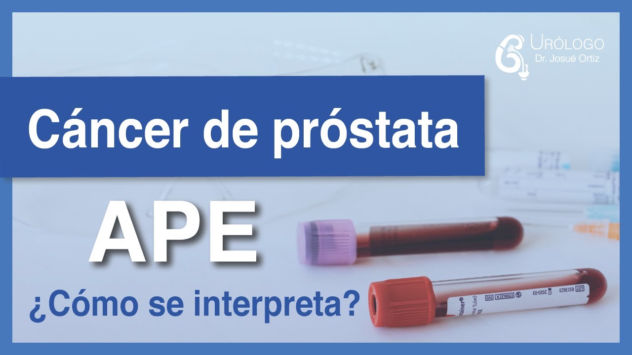 Cáncer de próstata - APE (Antígeno Prostático Específico) ¿Cómo interpretarlo?│URÓLOGO Josué Ortiz