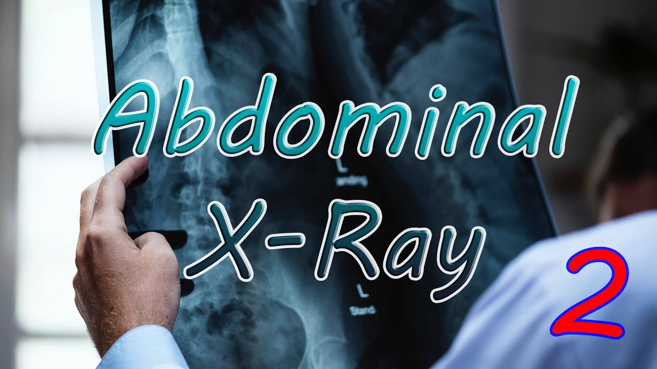 Abdominal X-ray interpretation (2) | Bowel perforation on AXR | ER images