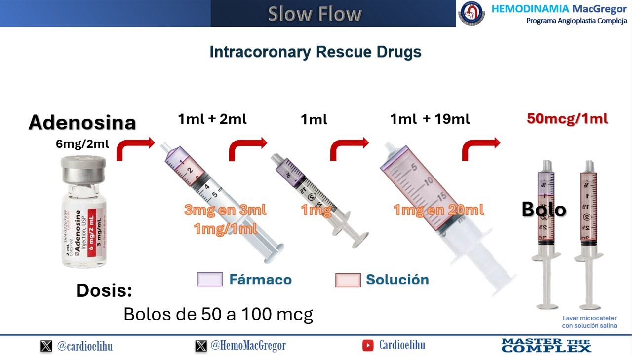 Intracoronary Rescue Drugs (Slow Flow)