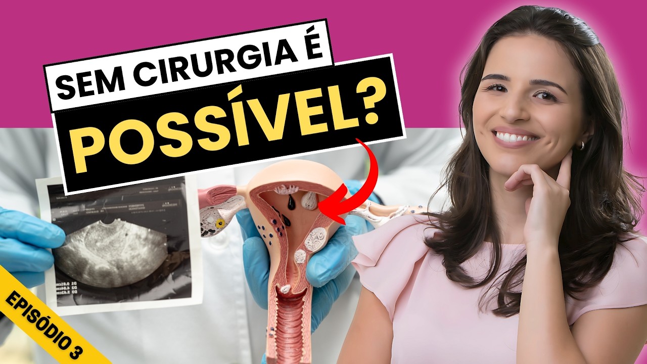 MIOMA UTERINO: TRATAMENTOS EFICAZES SEM CIRURGIA