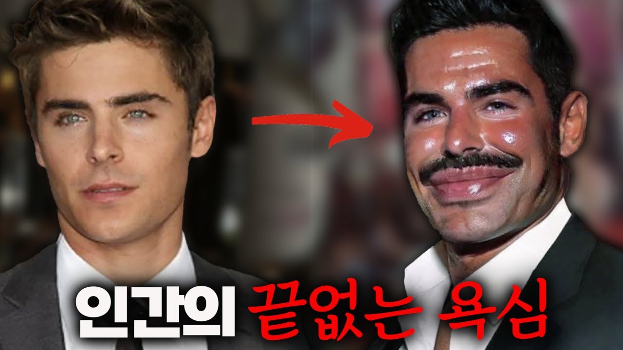 잭 에프론 얼굴에 무슨 일이 벌어졌나