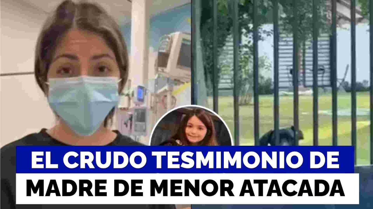 Comieron parte de su masa encefalocraneal: Ni&ntilde;a de 10 a&ntilde;os fue atacada m&aacute;s de 130 veces por perros