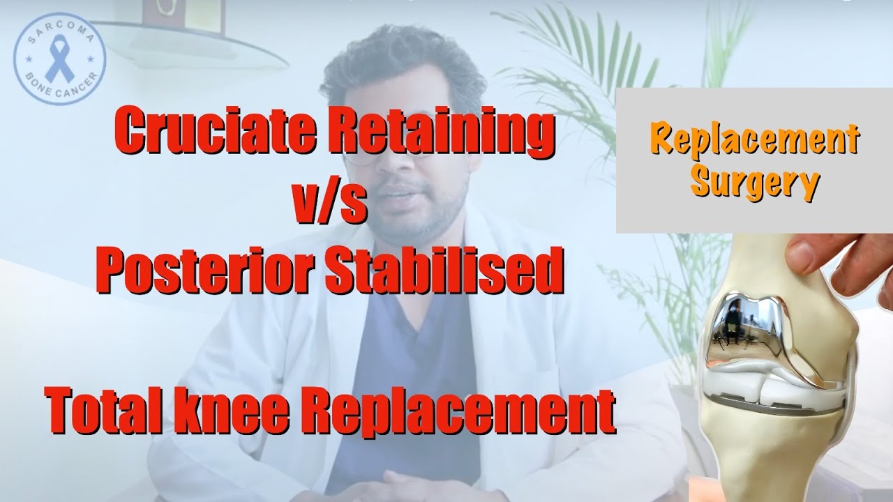 Cruciate Retaining vs. Posterior Stabilised Total knee Replacement, Which is better? Dr Deepak Garg