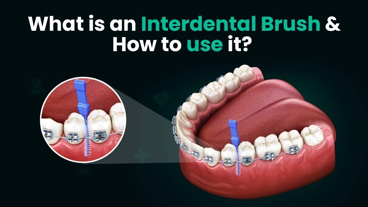 What is an Interdental Brush and How to use it? - 3D Step by Step Guide