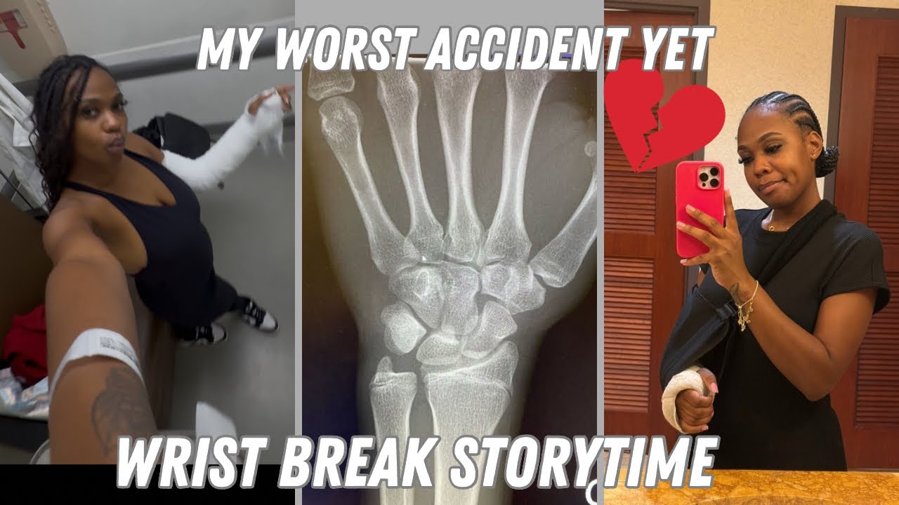 Storytime: I Broke My Wrist 🤕 | What Really Happened