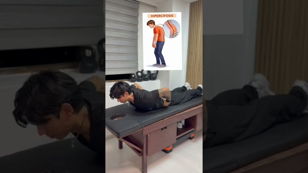 Ejercicios para joroba o hipercifosis dorsal