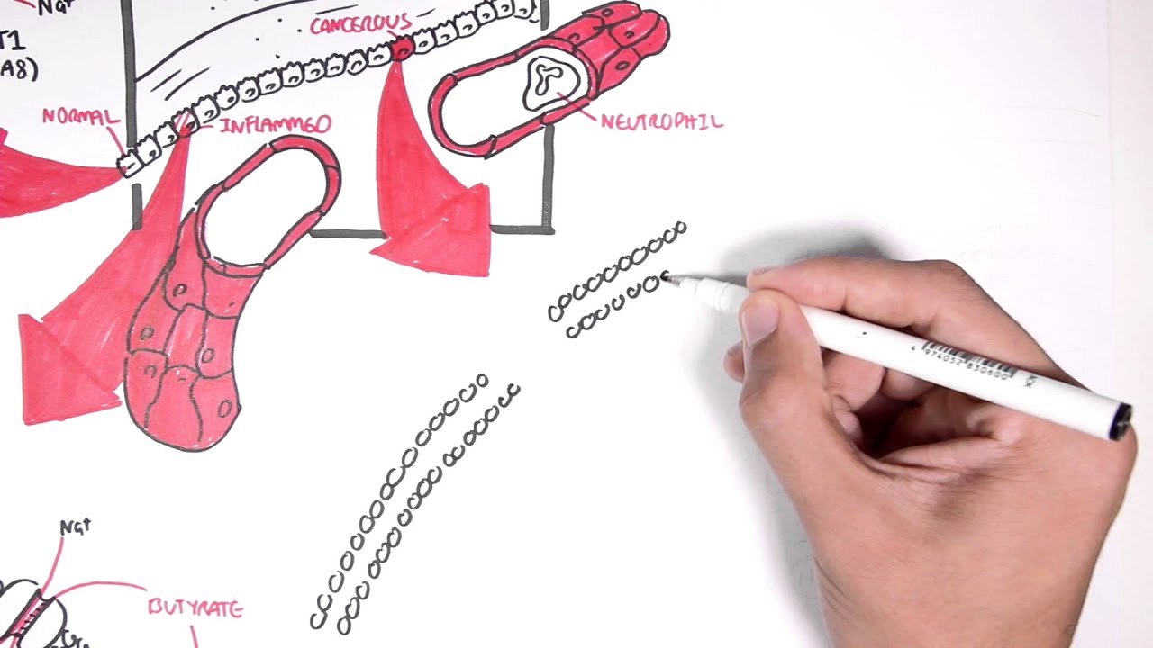 Molecular effects of Butyrate